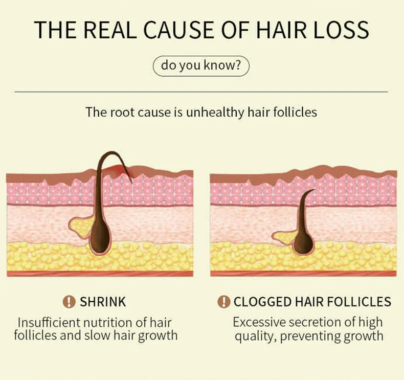 Batana Oil for Hair Growth Organic Hair Treatment Oil 6 batana oil hair growth organic treatment cih g6zaffch desc 6