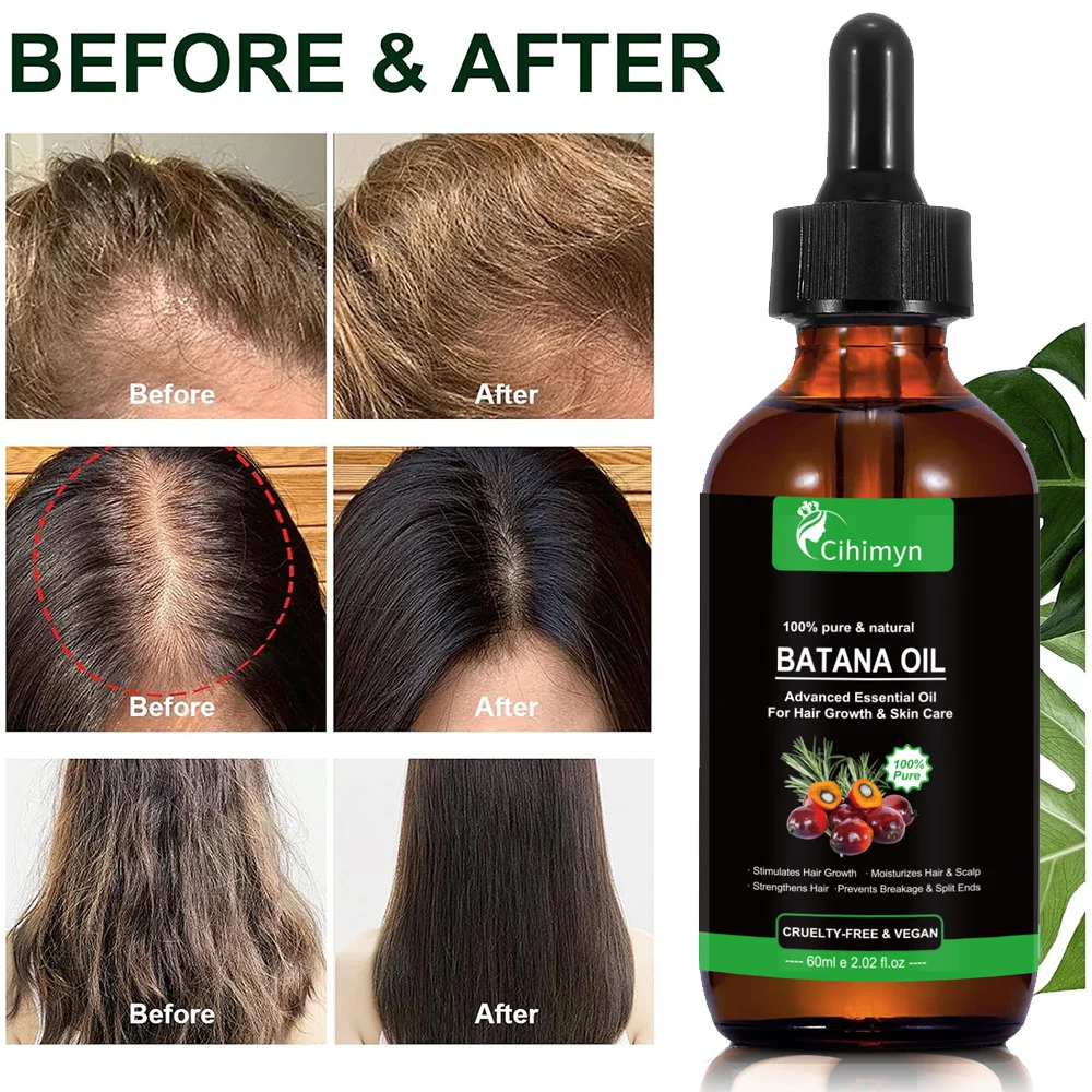 Batana Oil 100% Pure & Natural Hair Growth Serum for Scalp & Hair 3 batana oil hair growth serum sit 4xz8zhr8 desc 3
