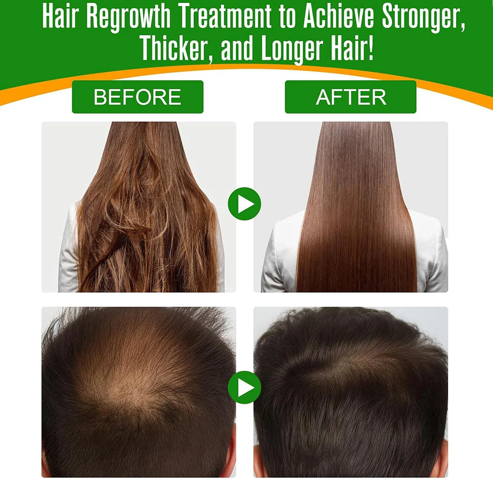 Batana Oil 60ml 100% Pure Hair Growth Oil for Scalp & Hair Care 8 batana oil hair growth serum sit 4xz8zhr8 desc 4