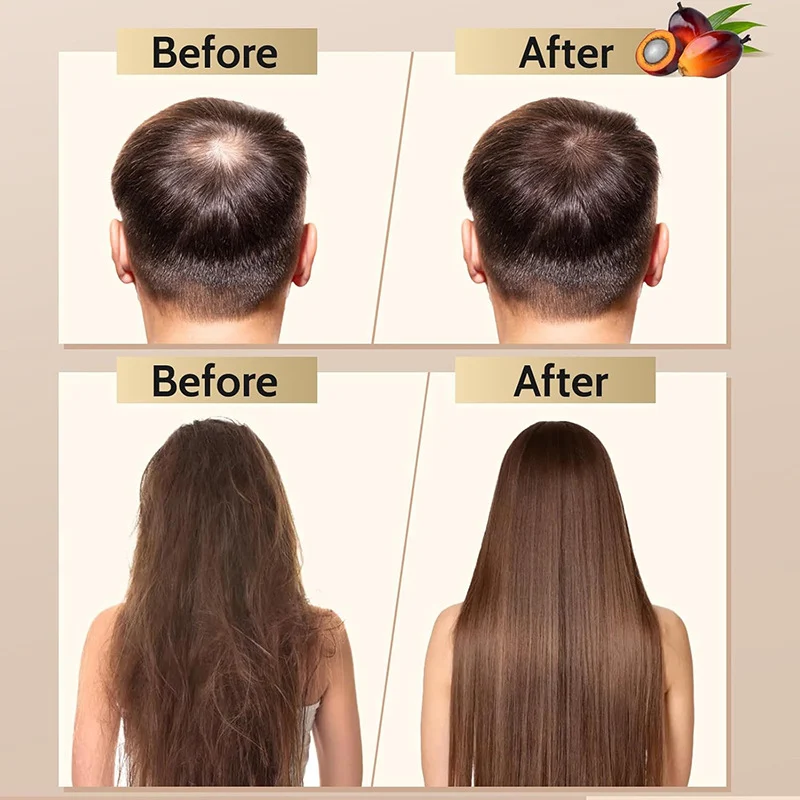 Batana Oil for Hair Growth 120g Natural Hair Thickening Treatment for Men & Women 4 batana oil hair growth thickening treatment sit tfussn6h desc 4