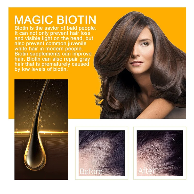 Biotin Hair Growth Oil Deeply Moisturizes Scalp, Reduces Hair Loss & Improves Hair Health 2 biotin hair growth oil sit uq8y8ydg desc 2
