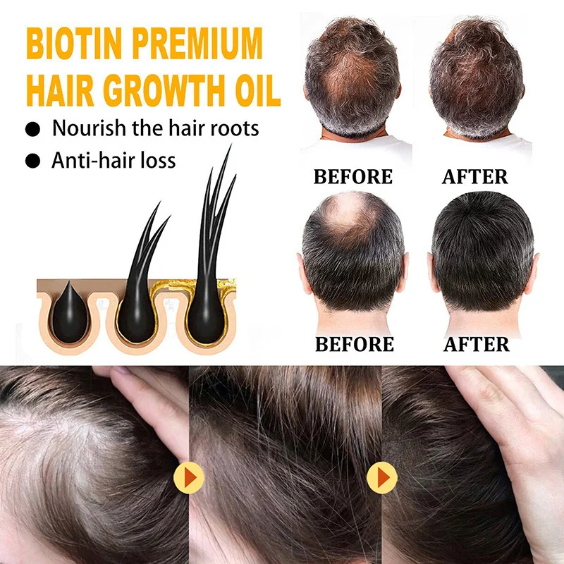 Biotin Hair Growth Oil Deeply Moisturizes Scalp, Reduces Hair Loss & Improves Hair Health 4 biotin hair growth oil sit uq8y8ydg desc 4