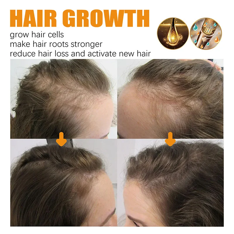 Biotin Hair Growth Oil Deeply Moisturizes Scalp, Reduces Hair Loss & Improves Hair Health 8 biotin hair growth oil sit uq8y8ydg desc 8
