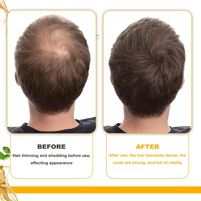Biotin Hair Growth Oil Deeply Moisturizes Scalp, Reduces Hair Loss & Improves Hair Health 9 biotin hair growth oil sit uq8y8ydg desc 9