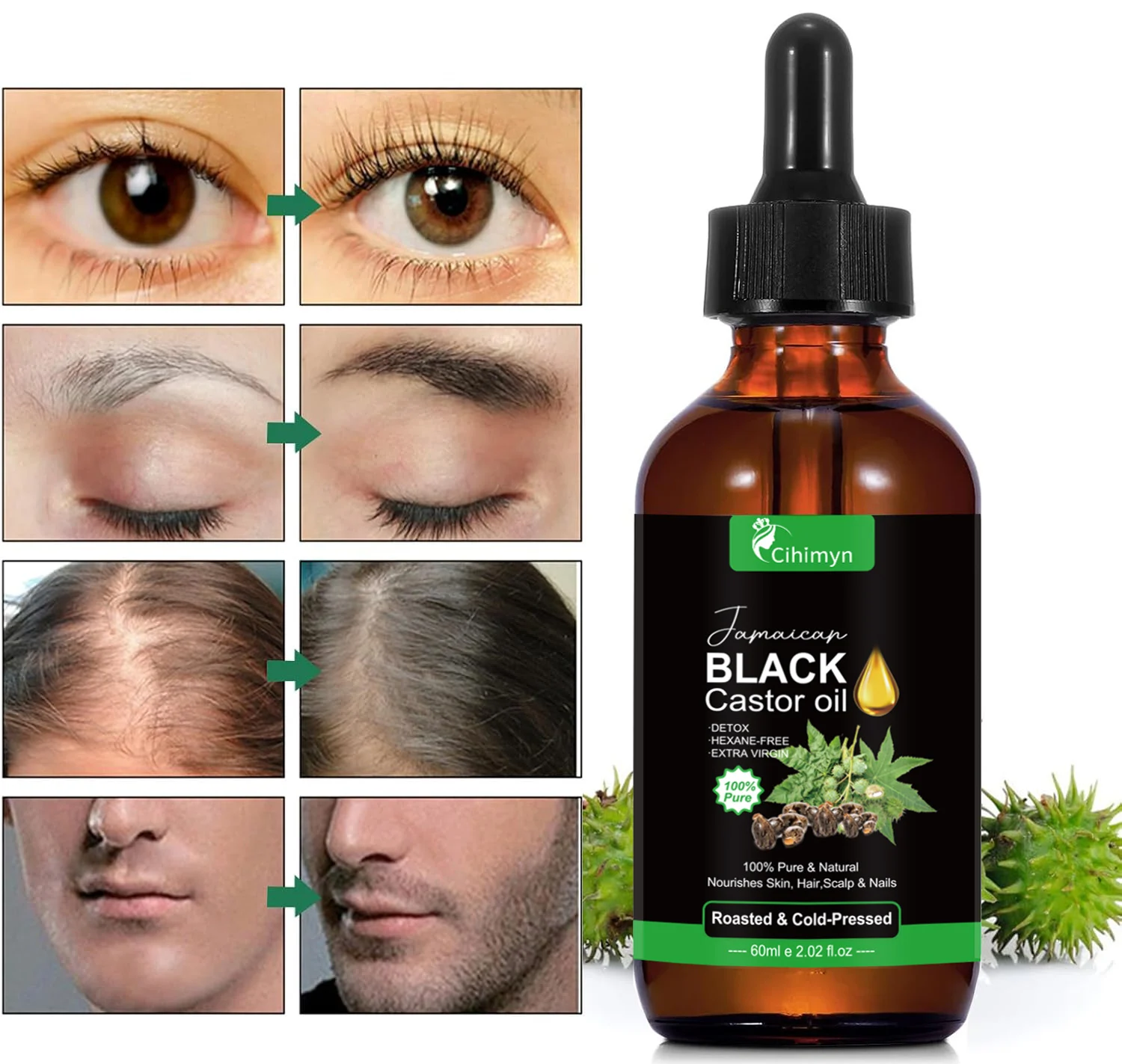 Jamaican Black Castor Oil for Hair Growth, Scalp & Skin Care, 100% Pure & Natural 5 jamaican black castor oil hair growth scalp skin care sit ahbxyths desc 5