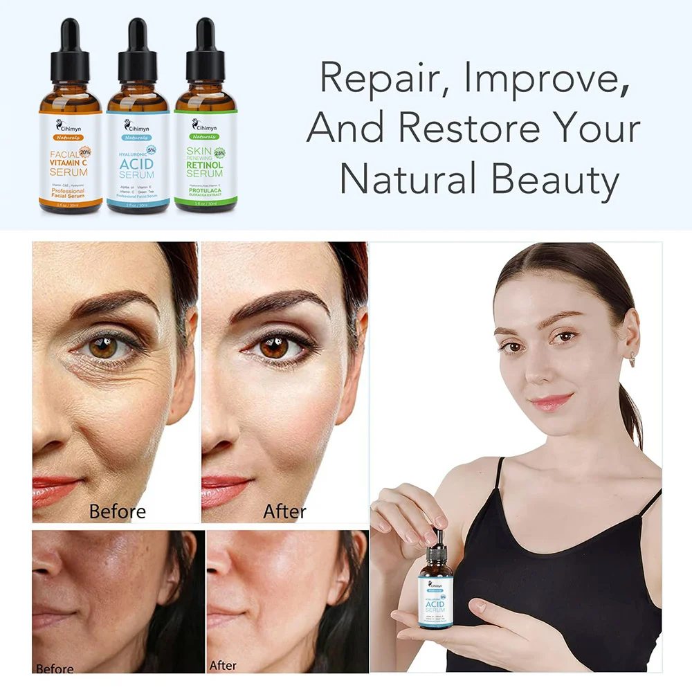 Retinol Serum with Hyaluronic Acid and Vitamin E 30ml Anti-Aging Face Treatment 4 retinol serum hyaluronic acid vitamin e anti aging face treatment sit 4ptrnuqs desc 4