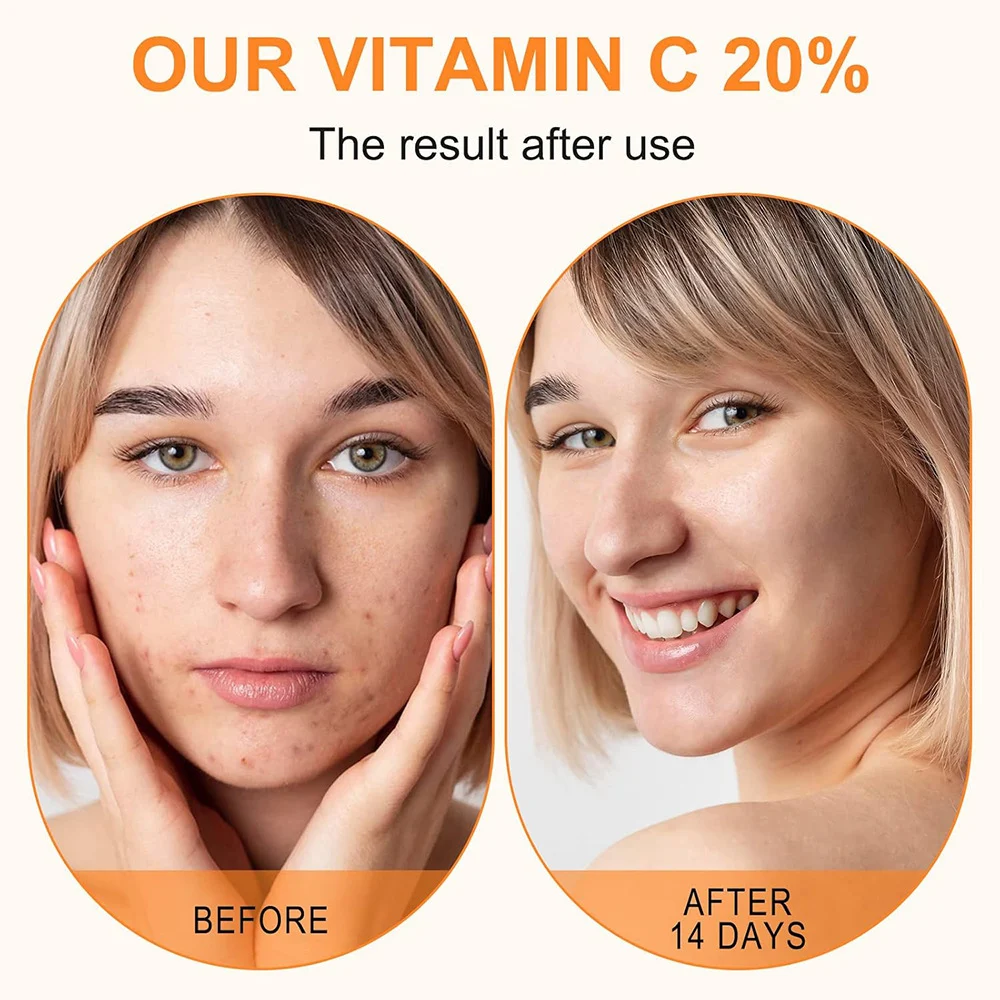 Retinol Serum with Hyaluronic Acid and Vitamin E 30ml Anti-Aging Face Treatment 9 retinol serum hyaluronic acid vitamin e anti aging face treatment sit 4ptrnuqs desc 9