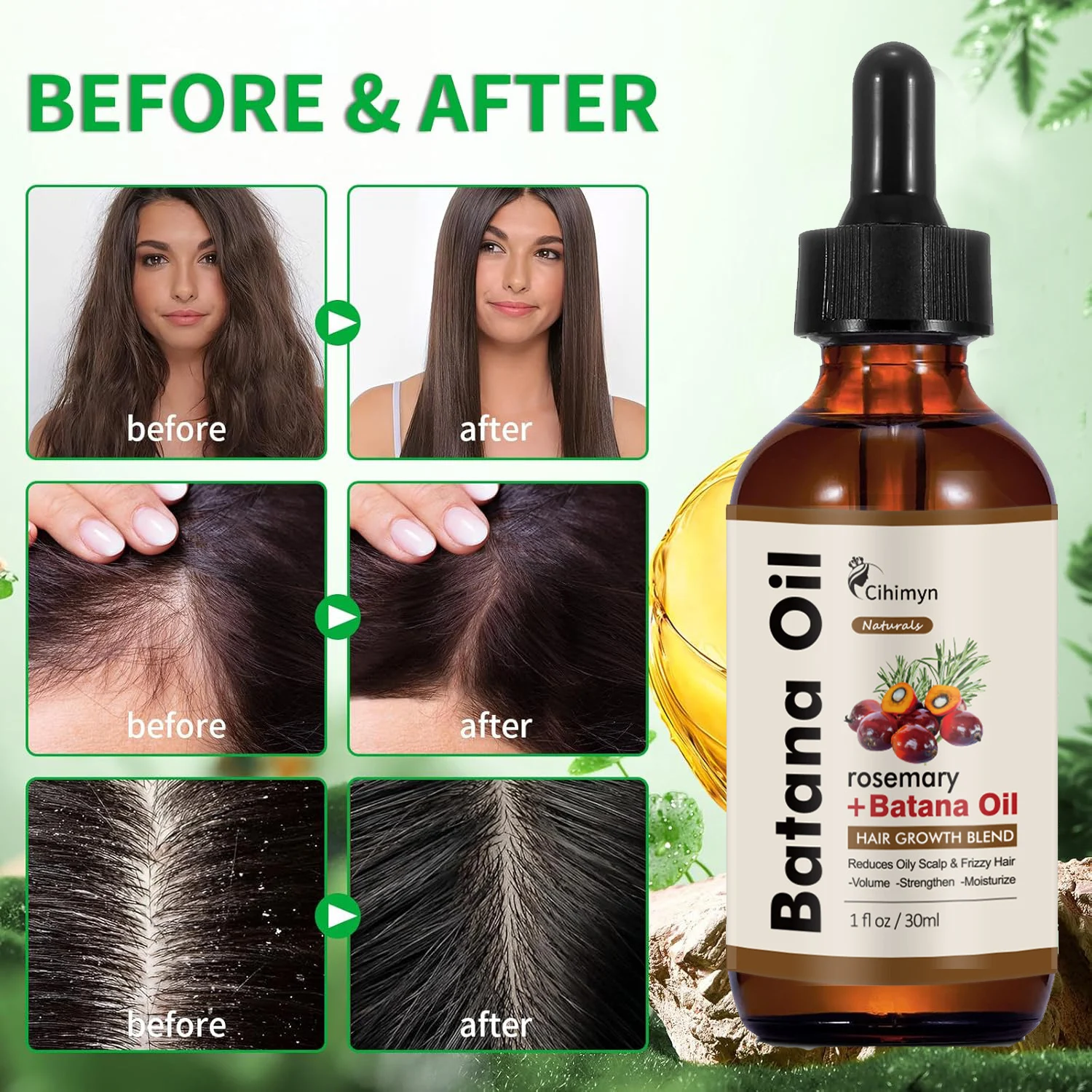 Rosemary Batana Hair Growth Oil Strengthens & Nourishes Hair & Scalp 30ml 6 rosemary batana hair growth oil 30ml sit g3g5kubb desc 6