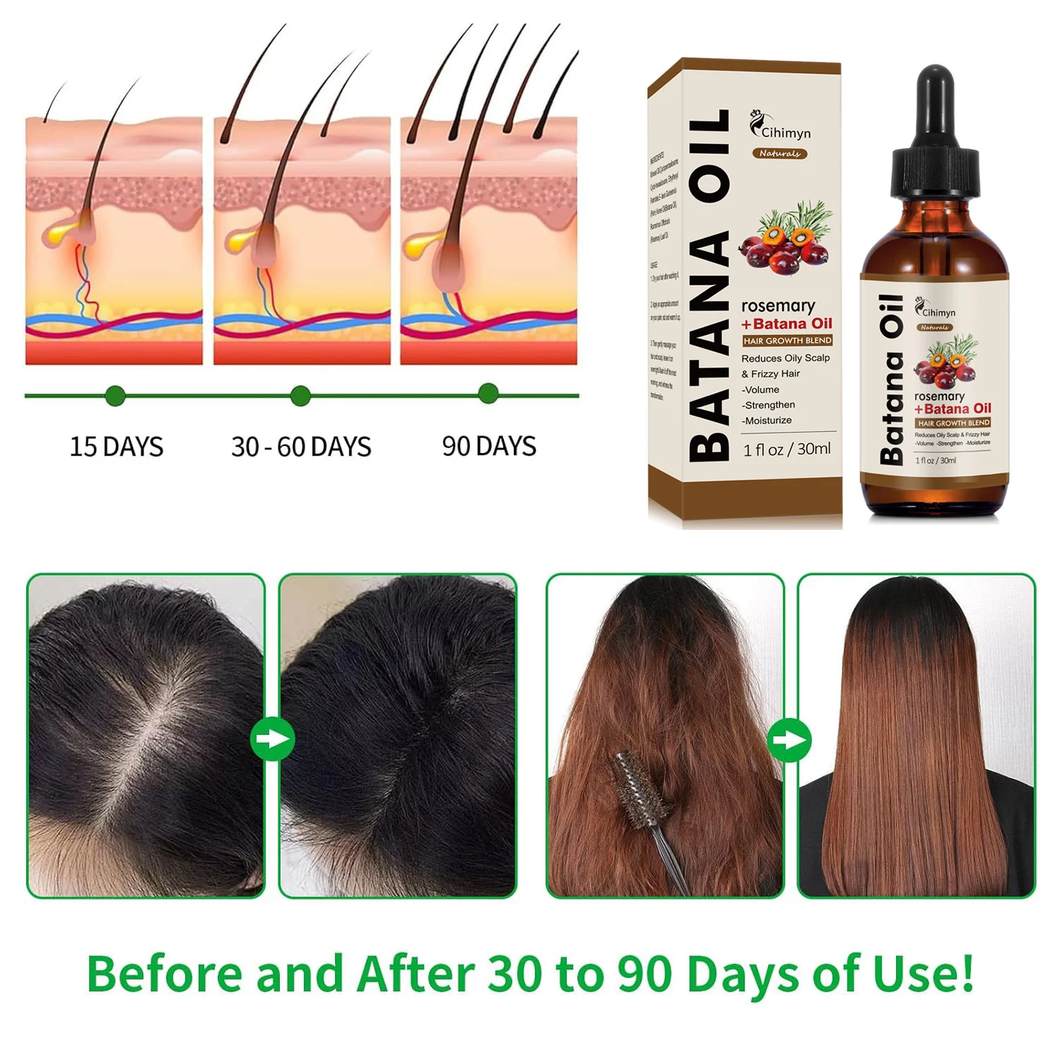 Rosemary Batana Hair Growth Oil Strengthens & Nourishes Hair & Scalp 30ml 7 rosemary batana hair growth oil 30ml sit g3g5kubb desc 7