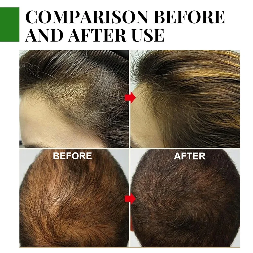 Rosemary Essential Oil for Hair Growth, Scalp Nourishing & Hair Care 30ml 11 rosemary essential oil hair growth 30ml sit xxvf67uk desc 11