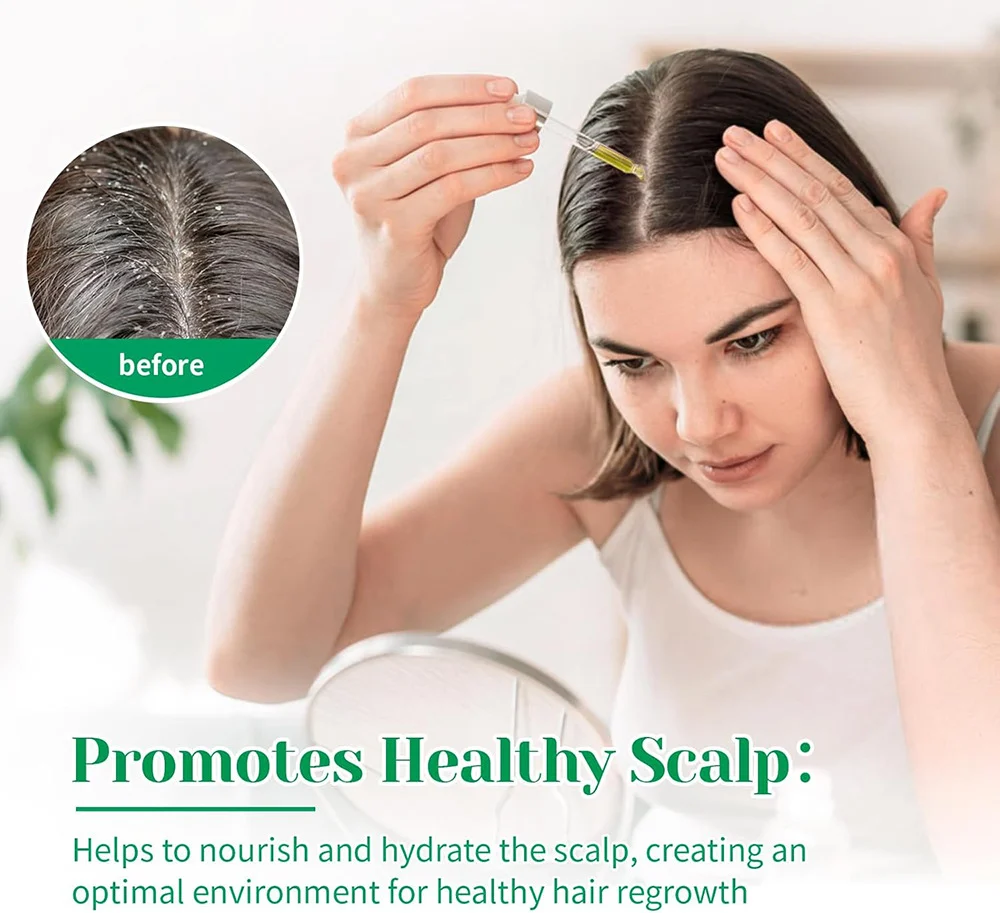 Rosemary Essential Oil for Hair Growth, Scalp Nourishing & Hair Care 30ml 6 rosemary essential oil hair growth 30ml sit xxvf67uk desc 6