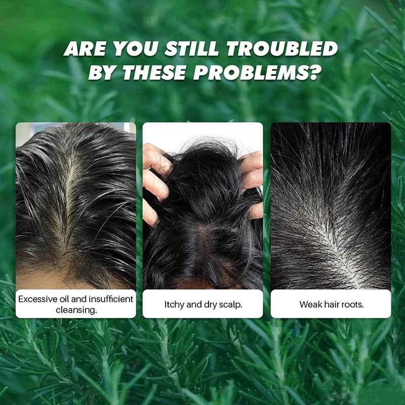 Rosemary Mint Scalp Scrub Shampoo Deep Cleansing & Oil Control with Massage Comb 100g 2 rosemary mint scalp scrub shampoo massage comb 100g sit kcdycvvg desc 2