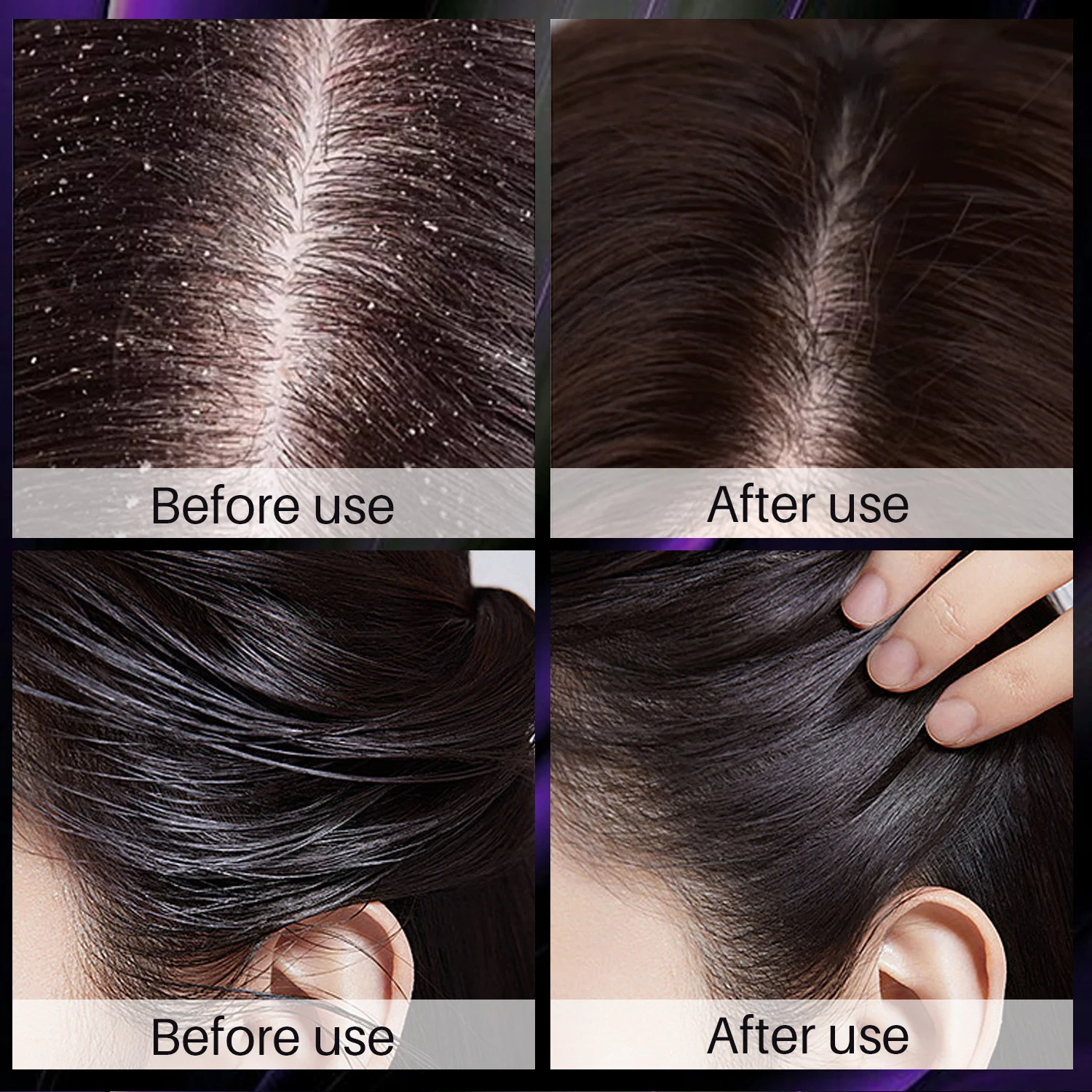 Rosemary Onion Mint Strengthening Shampoo Repair Damaged Hair Promote Growth 100ml 5 rosemary onion mint strengthening shampoo sit defne8kk desc 5
