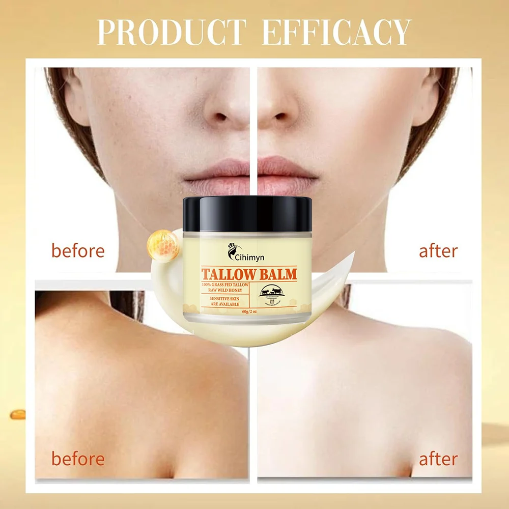 Tallow Balm 100% Grass-Fed Tallow & Raw Wild Honey Moisturizing Cream for Sensitive Skin, Anti-Acne, Brightening, 60g 3 tallow balm grass fed wild honey moisturizing cream 60g sit namb6etn desc 3
