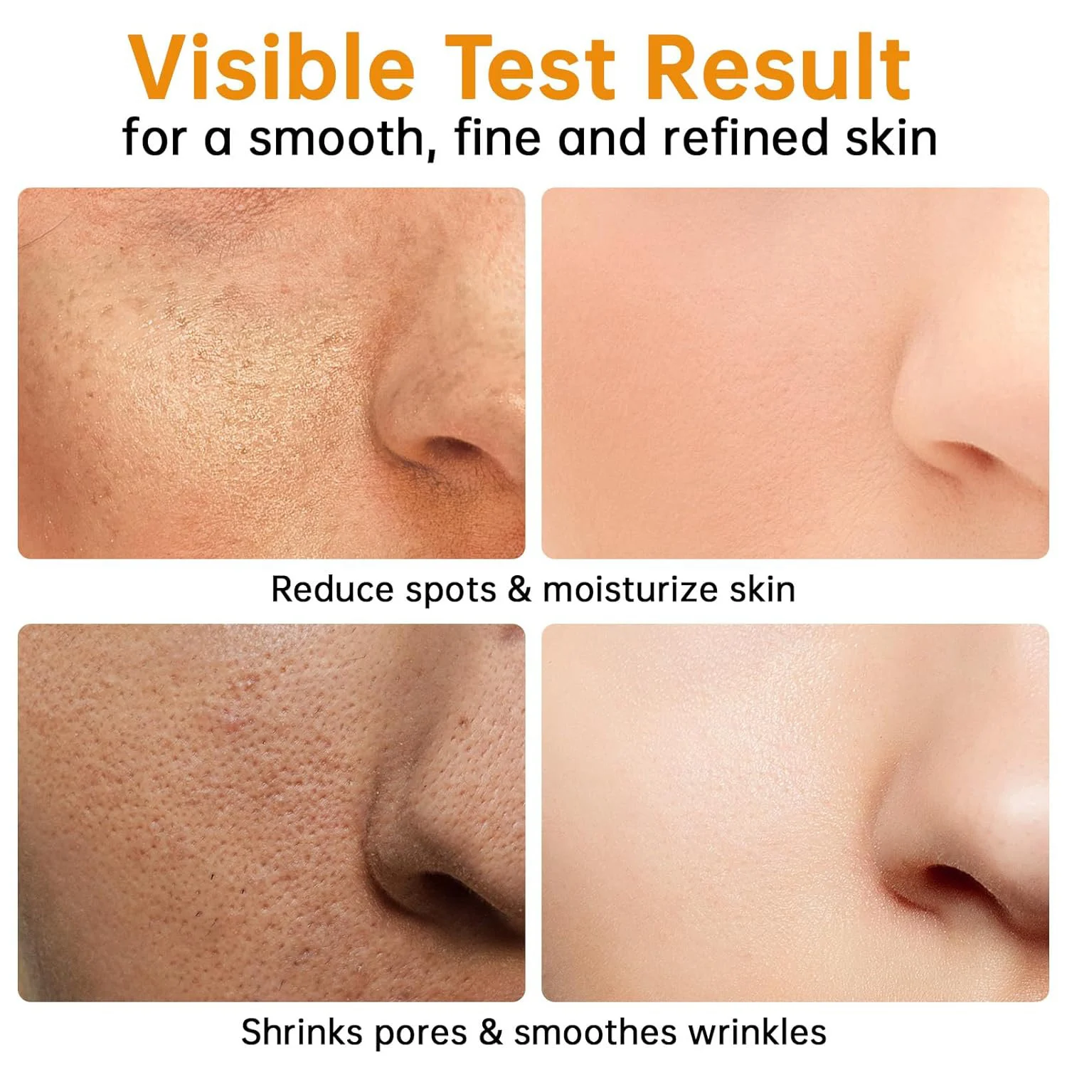 Turmeric VC Serum Hydrate Glow Brighten Tighten Skin 30ml 5 turmeric vc serum hydrate glow brighten tighten skin 30ml sit wt57rpcc desc 5