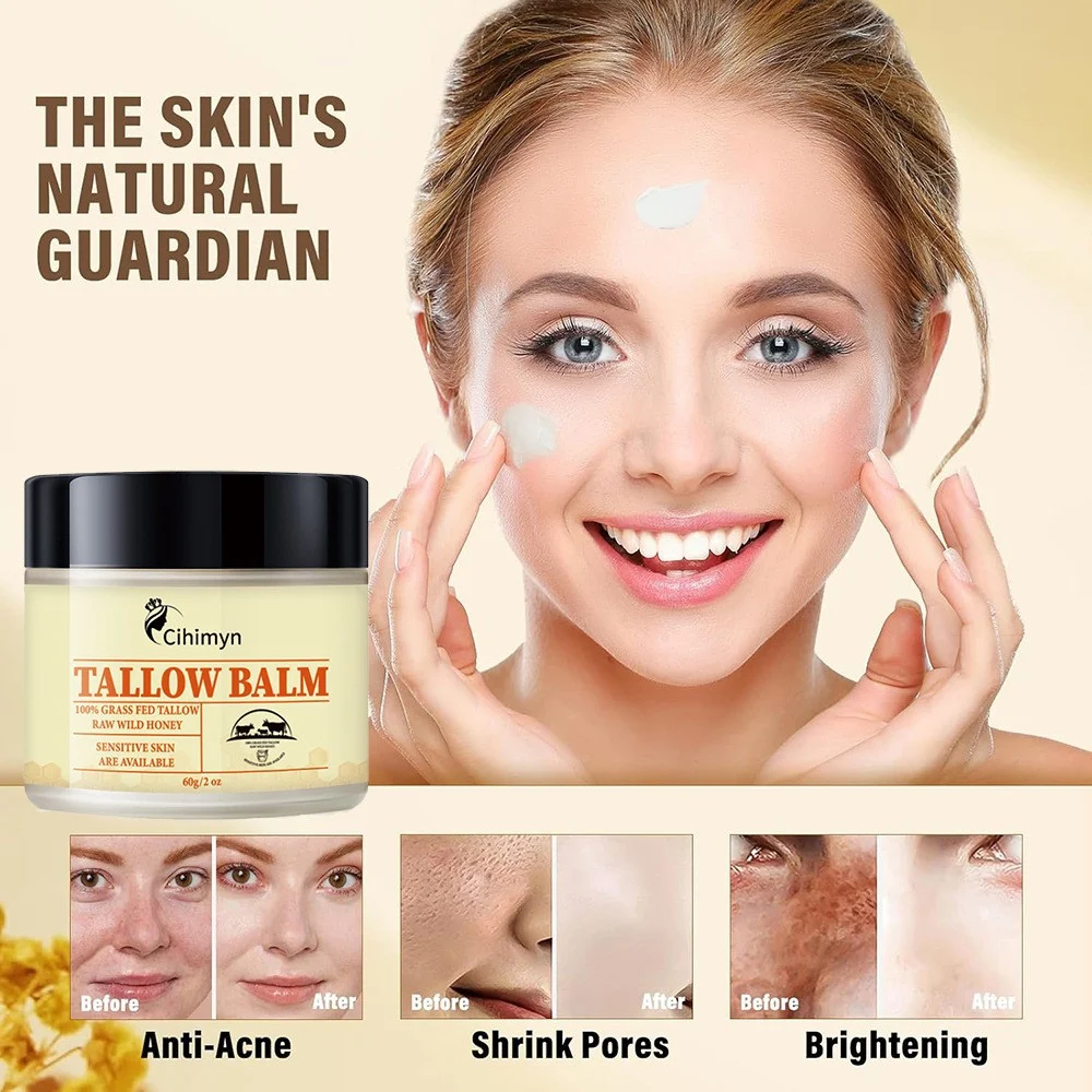 Tallow Balm Whipped Tallow & Honey Balm 100% Grass Fed Moisturizing Skincare Cream 4 whipped tallow honey balm sit 7ge2p9kd desc 4